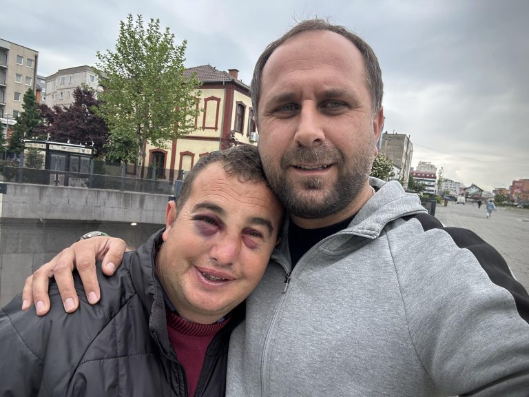 Tronditëse: Sulmohet ‘Cufa’, qytetari me aftësi të kufizuara nga Ferizaj