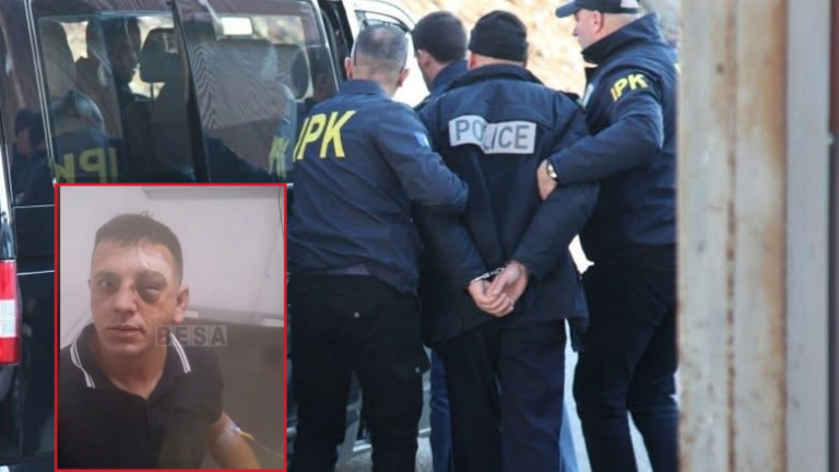 Refuzoi të pranojë gjobën, polici e godet disa herë me grushta qytetarin në Prizren