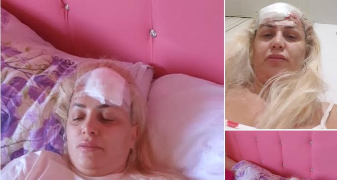 Vajza që u qëllua me çekan nga babai, e ka Hashim Thaçin tatuazh në trup