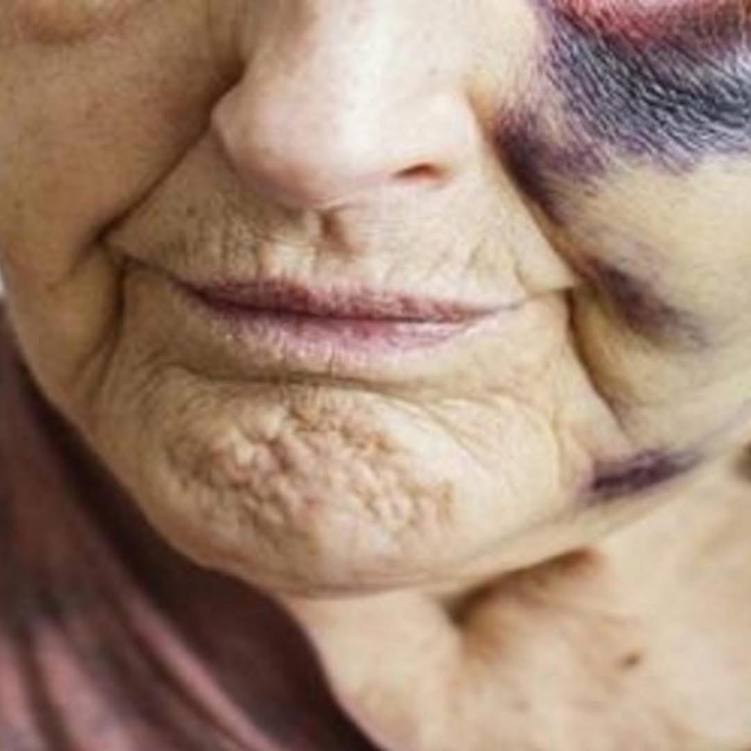 E rëndë: Djali 21-vjeçar e kap për fyti nënën dhe e rrah