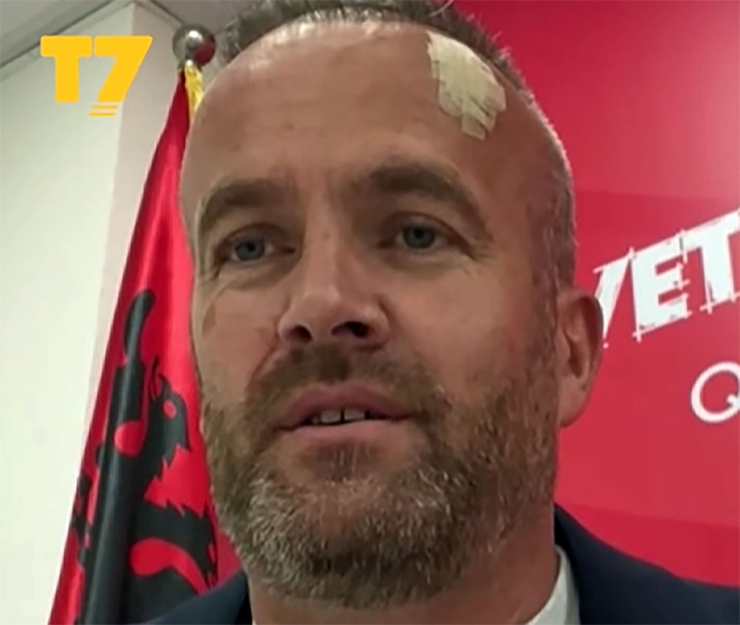 Mehani i VV-së pas incidentit me Lushtakun: tregon versionin e plotë të ngjarjes